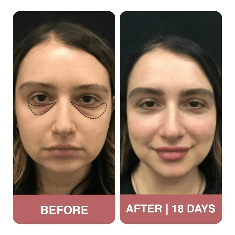 I’ve tried many under-eye concealers.