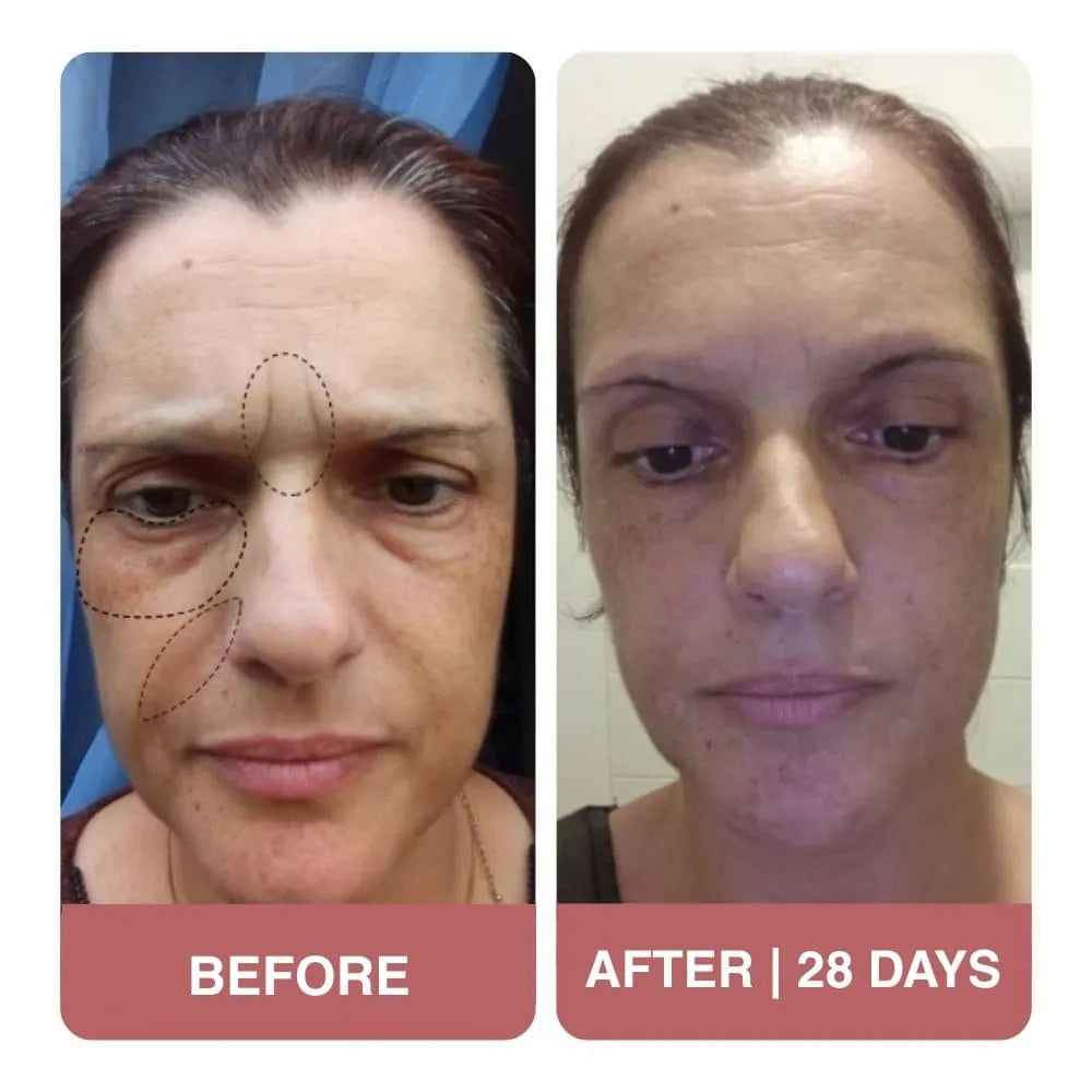 This Wombea cream is impressive !